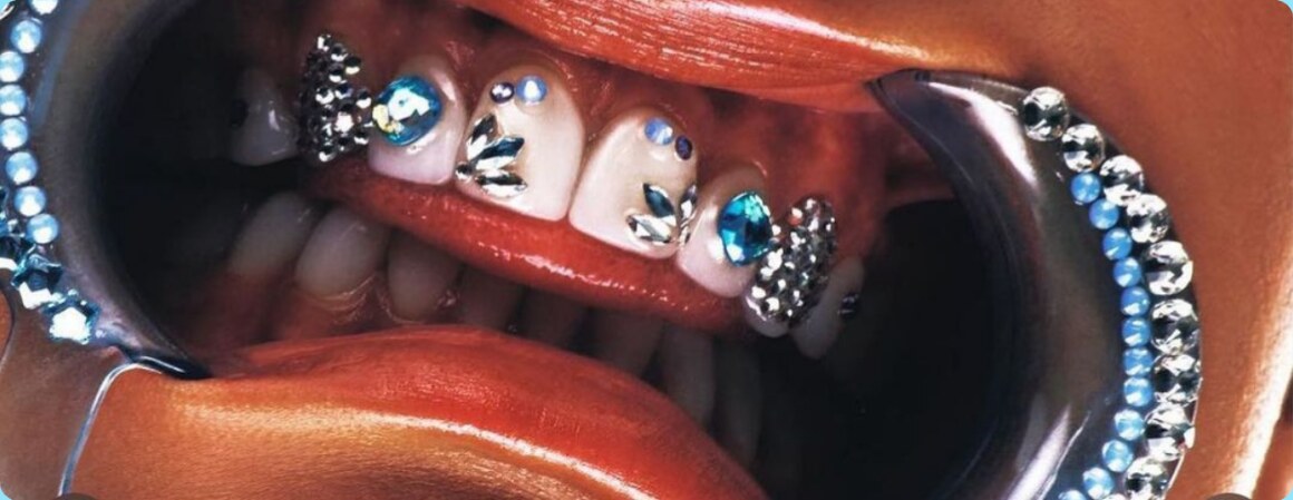 Sorriso com uma composição marcante de piercing dental